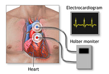 Photo of هولتر مانیتورچیست و کاربرد آن در پایش سلامت قلبی عروقی