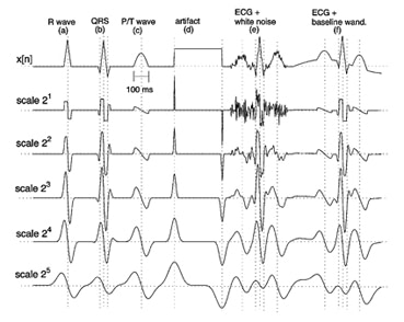 نتایج محاسبه DWT بر روی پنج مقیاس اول بر روی سیگنال های شبیه سازی شده مشابه با ECG