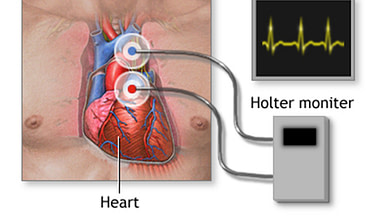 Photo of هولتر مانیتورچیست و کاربرد آن در پایش سلامت قلبی عروقی